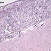 Nov 16, 2020 · the viruses that cause meningitis include the influenza virus, mumps, measles virus, and herpes virus. 1