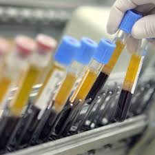 Image result for Fatigue Diagnostic Testing