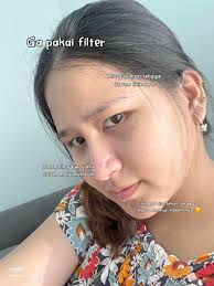 Review d'Alba First Spray Serum: Mengatasi Jerawat dan Breakout