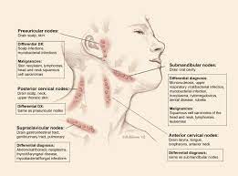 Very rarely, things like sarcoidosis or tuberculosis can cause swollen lymph nodes to this area. Lymphadenopathy Cancer Therapy Advisor