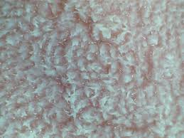 Image result for Filiform Papillae