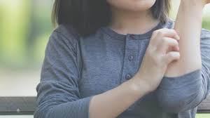 Before you start running some warm water, here's what to know. Epsom Salt For Eczema