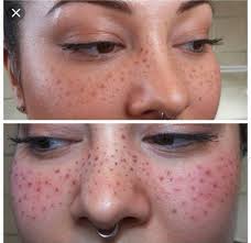 Pin By We The Peculiars On Cosmetic Tattoo Tattooed Freckles Permanent Makeup Freckles