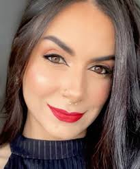 Antes e depois de 4 anos após realizar Bichectomia. E que resultado  incrível, tá?! ✨ Sempre falamos com os nossos pacientes, a Bichectomia não  acelera o envelhecimento, mas precisa ser muito bem