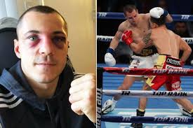 Scott Quigg shows off gruesome face wounds after points loss to Oscar  Valdez but insists he will come back stronger