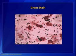 Image result for Group B Streptococcus Prophylaxis