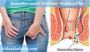 Pin Em Propiedades Curativas De Algunos Alimentos Y Hierbas