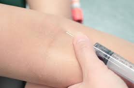 Gap between vaccine doses could be 6 weeks. Ppd Skin Test For Tuberculosis