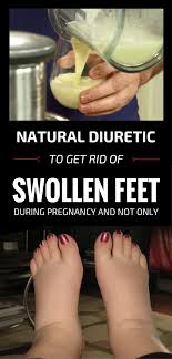 Natural Diuretic To Get Rid Of Swollen Feet Swollen Feet Remedy Swollen Feet Foot Remedies
