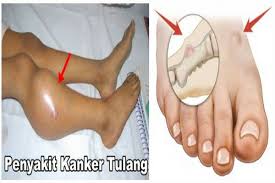 We did not find results for: Mengenal Kanker Pada Anak History Ranurri