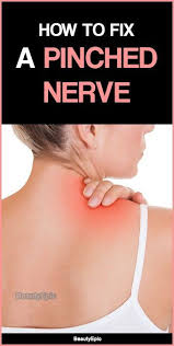 How To Fix A Pinched Nerve Causes Symptoms Treatments Pinched Nerve Pinched Nerve Relief Neck Pinched Nerve Relief