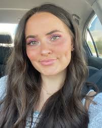 Abby Ackley's Instagram, Twitter & Facebook