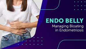 As a gynaecologist with stage iv endometriosis herself, she says you can look six months pregnant by the end of the day. Endo Belly Managing Bloating In Endometriosis Myendometriosisteam
