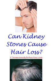 What Would Cause Hair Loss Hair Loss Treatment Hair Loss Remedies Anti Hair Loss