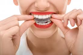 Did my ortho treatment relapse? Tips For Taking Care Of Your Invisalign Trays Roberto Palmieri Dmd Cosmetic Dentistry