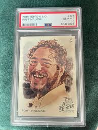 Why is the 2017 Topps Mc Archival RC logo missing?