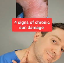 Dr. Scott Walter, MD, FAAD