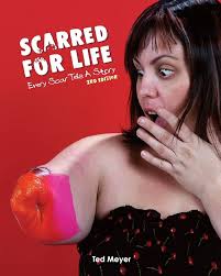 Amazon.com: Scarred for Life. 2nd Edition: Every Scar Tells A Story:  9781985007321: Meyer, Ted: Books
