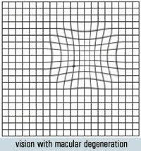 Amsler Grid Printable Google Search Grid Search