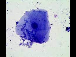 Animal cells tend to lack cell walls and chloroplasts, while plant cells do contain chloroplasts and have cellulose cell walls. Cheek Epithelial Cells How To Prepare A Wet Mount Microscope Slide Youtube