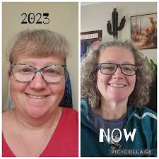 I would do it a thousand times over 🤗🙌🏼⭐️ best decision ever made 👍 do  it please it will change your life 🧡