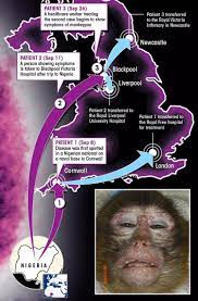 Matt hancock says there's a 'uk outbreak' the monkeypox virus is a rare disease which health authorities this week confirmed has been detected in the uk. Monkeypox Outbreak Fears Grow As Healthcare Worker Becomes Third Person To Catch Deadly Disease In Uk