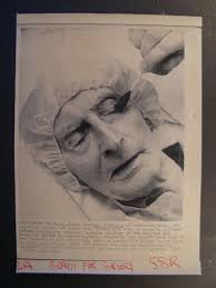 AP Wire Press Photo 1985 John Stenberg 100 of Mass having Cataract Surgery 