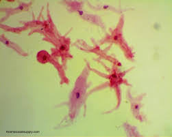 Tests to differentiate these species are not yet widely available in laboratories. Amoeba Quotes Quotesgram