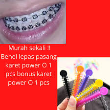 Segala macam persiapan sebelum pemasangan kawat gigi tersebut membutuhkan uang yang tidak sedikit. Murah Sekali Behel Lepas Pasang Karet Power O 1 Pcs Bonus Karet Power O 1 Pcs Lazada Indonesia