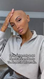 🙏🏽🤍, #hairloss #alopecia #mystory #alopeciatreatment  #fypppppppppppppppppppppppppppppppppppppppppppppppppppppppppppppppppppppp