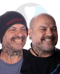 Tijuana Dentist Advanced Smiles Dentistry