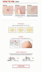 Cosrx Acne Pimple Master Patch 24 Patches Pimples Cosrx Acne
