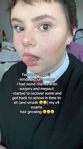 Osteosarcoma in Shoulder