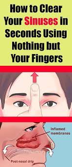 How To Clear Your Sinuses In Seconds Using Nothing But Your Fingers Clear Sinus Healthcare Sinusitis Health How To Clear Sinuses