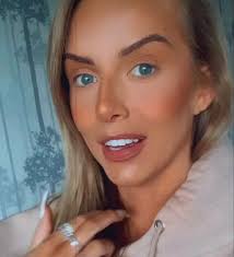 Love Island's Faye Winter shows off incredible new look after getting lip  filler dissolved