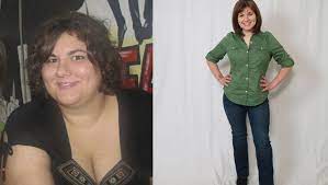 Before and after weight loss. The Hardest Part Of Weight Loss Surgery