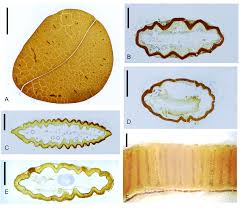 Image result for Paropsia