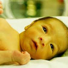 In the majority of cases, it appears in the first week of life and is classified as physiologic due to accelerated destruction of erythrocytes and liver immaturity. Neonatal Jaundice Doctor Kt