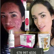 Jose Peñate (jjoaquin7735)