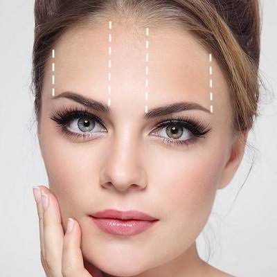 Brow Lift Surgery in Abu Dhabi & Al Ain | Cost & Price
