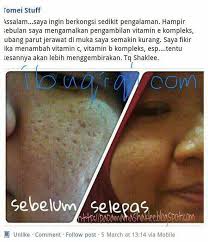 Ianya akan menganjalkan kulit dan kulit terasa lebih lembut keesokan paginya. Testimoni Vitamin E Shaklee Umi Nazrah
