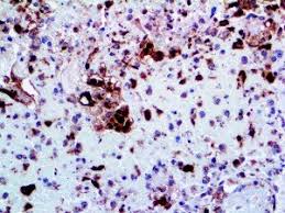 If anyone's interested i'm sure i could dig up some old pictures of it. Herpes Simplex Ii Antibody Rpab Bio Sb