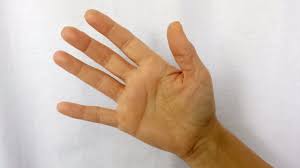 Tabloul clinic netratarea gutei poate avea urmari cronice. ArticulaÈ›iile Degetelor Se UmflÄƒ DupÄƒ Somn Boli Ereditare Ale È›esutului Conjunctiv