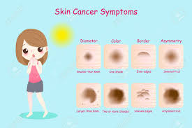 This may be because cancer cells use up much of the body's skin changes such as a lump that bleeds or turns scaly, a new mole or a change in a mole, a sore that does not heal, or a yellowish color to the skin or. Woman With Skin Cancer Symptoms On The Blue Background Royalty Free Cliparts Vectors And Stock Illustration Image 100836351