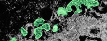 The most recent outbreaks of marburg virus disease have occurred in uganda. Researchers Develop Marburg Virus Treatment Effective Five Days After Infection Tmc News