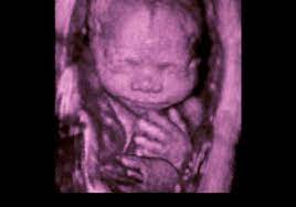 Check spelling or type a new query. 3d Or 4d Ultrasound Vs 2d Ultrasound