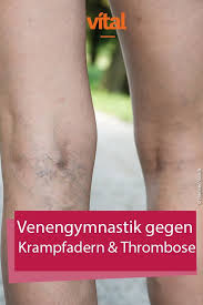 Avgs can be cannulated earlier after creation than avfs, but are 3.8 times more likely to thrombose and require thombectomy, and are 3.0 times more likely to require access intervention to maintain patency compared to a fistula (oliver, 2015). Pin On Bok Isaacs Board Blog And Diy