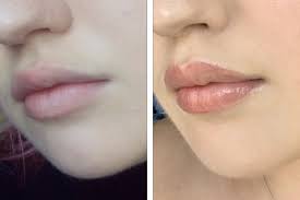 I Got Lip Blushing And It Made Me Love My Lips Even More Hellogiggles