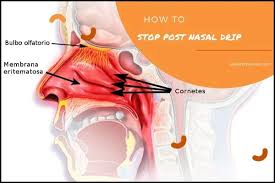 How To Stop Postnasal Drip In 2020 Post Nasal Drip Remedy Stop Post Nasal Drip Mucus In Throat