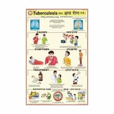 Tb Patient Diet Chart In Hindi Bedowntowndaytona Com